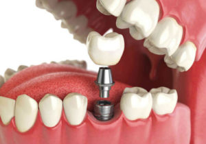 ортопедическая стоматология