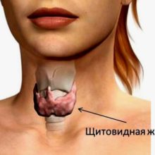 Заболевания щитовидной железы и их проявления