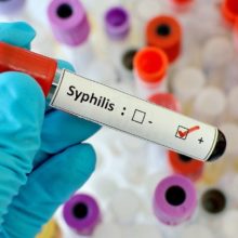 Сифилис. Стадии, диагностика и лечение