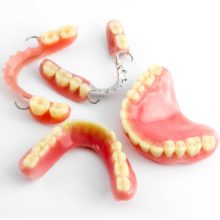 Виды зубных протезов и их особенности