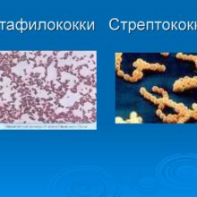 Инфекции, вызванные стафилококками и стрептококками