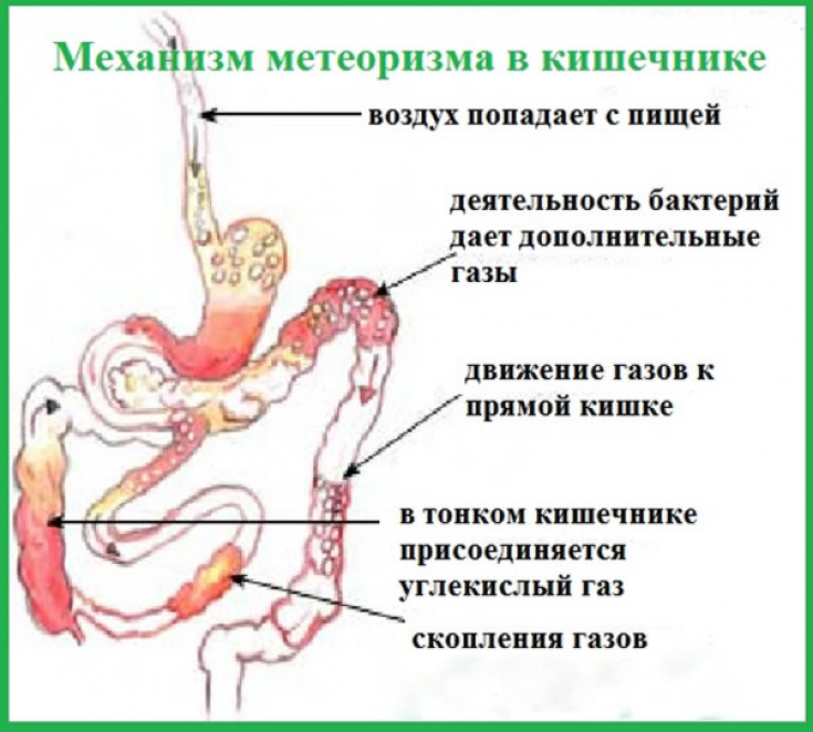 Метеоризм кишечника лечение у взрослых мужчин. Метеоризм. Механизм газообразования в кишечнике. Вздутие живота и газообразование.
